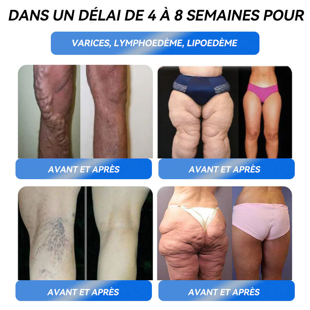 𝑪𝒓𝒐𝑨𝒊𝒆® 𝑮𝒐𝒖𝒕𝒕𝒆𝒔 𝑴𝒊𝒏𝒄𝒆𝒖𝒓 𝑮𝑳𝑷-𝟏 & 𝑵𝑨𝑫+ ⚡ - 𝑶𝒃é𝒔𝒊𝒕é, 𝒎𝒂𝒍𝒂𝒅𝒊𝒆𝒔 𝒄𝒂𝒓𝒅𝒊𝒐𝒗𝒂𝒔𝒄𝒖𝒍𝒂𝒊𝒓𝒆𝒔, 𝒅𝒊𝒂𝒃è𝒕𝒆, 𝒂𝒑𝒏é𝒆 𝒅𝒖 𝒔𝒐𝒎𝒎𝒆𝒊𝒍, 𝒑𝒓𝒐𝒃𝒍è𝒎𝒆𝒔 𝒂𝒓𝒕𝒊𝒄𝒖𝒍𝒂𝒊𝒓𝒆𝒔 𝒆𝒕 𝒑𝒍𝒖𝒔 𝒆𝒏𝒄𝒐𝒓𝒆